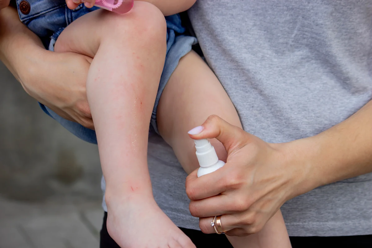 Liniment sur genoux d'un enfant